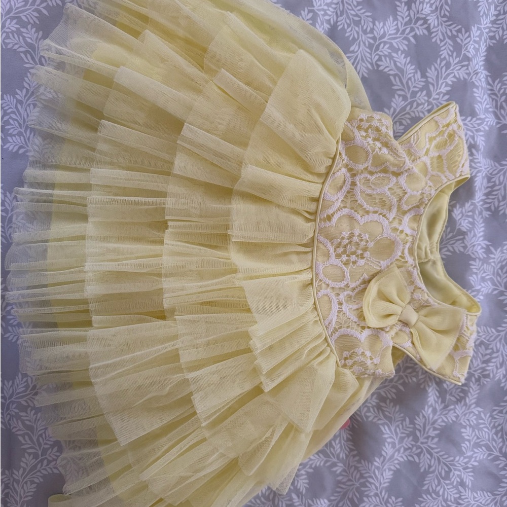 Yellow Lace Baby Dress